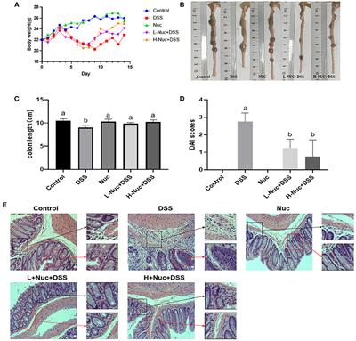 Nuciferine Regulates Immune Function and Gut Microbiota in DSS-Induced Ulcerative Colitis